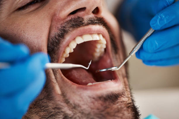 Best Orthodontic Emergency Dentist in Fairfield, IL