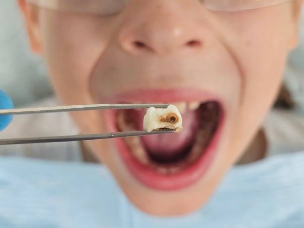 Best Pediatric Emergency Dentist in Fairfield, IL